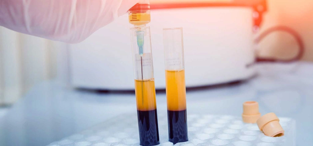 تعداد جلسات پی آر پی مو