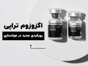 اگزوزوم