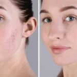 کاربرد اگزوزوم تراپی چیست؟