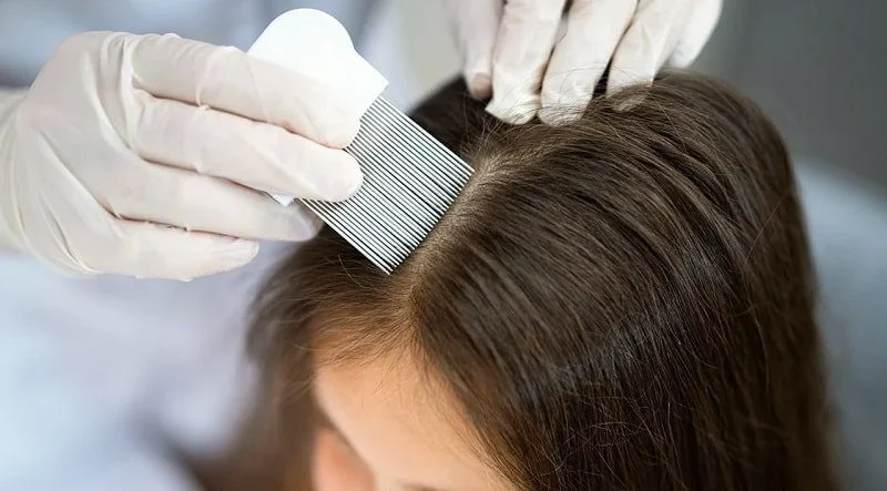 چه آزمایشاتی برای ریزش مو باید انجام شود؟