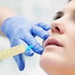 تزریق چربی به روش نانوفت چیست؟ چه کاربردی دارد؟