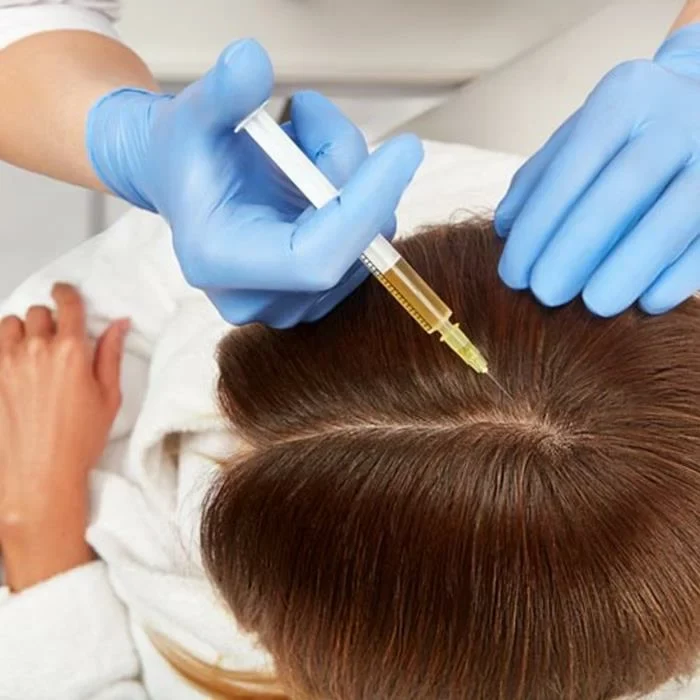 جدیدترین روش کاشت مو طبیعی