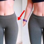 فرمدهی به بدن بدون جراحی - تزریق فیلر هیپ دیپ