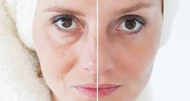 جوانسازی پوست