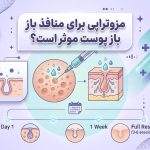 مزوتراپی برای منافذ باز پوست موثر است؟